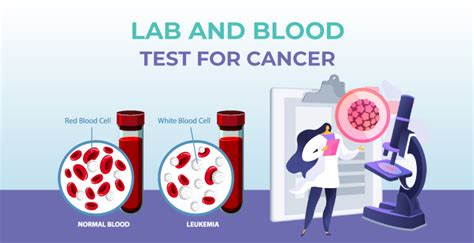 lab tests for melanoma